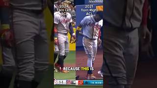 Acuna Torn ACL Again  mlb baseball sports shortsfeed shorts braves atlanta acuña injury [upl. by Anwahsal]