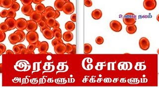 இரத்த சோகை அறிகுறிகளும் சிகிச்சைகளும்  Anemia Symptoms amp Treatment [upl. by Hplar]