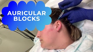 How to do an auricular block nerve block if an earring is stuck [upl. by O'Donoghue905]