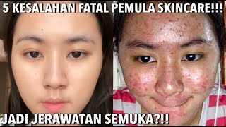 SKINCARE UNTUK REMAJA amp PEMULA MURAH amp AMAN  5 KESALAHAN REMAJA BIKIN JERAWATAN  INNERTRUE [upl. by Eggett]