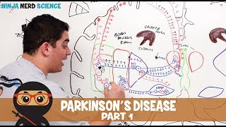 Parkinsons Disease  Clinical Presentation  Part 1 [upl. by Enilav]