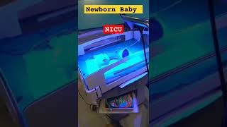 Jaundiced Newborn Baby NICU babydocter newbornbaby video cute baby doctor cutebaby borneba [upl. by Faunia]