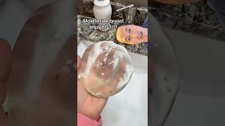 How Do You Get Mold Inside Breast Implants [upl. by Zenas]