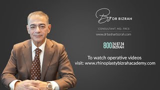 Rhinoplasty Bizrah Masterclass11 Understanding the Fundamentals of Tip Plasty [upl. by Madriene932]