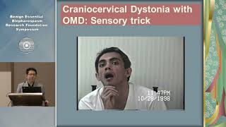 Oromandibular Dystonia and Meige Syndrome Virgilio Gerald H Evidente MD [upl. by Little212]