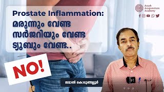 Prostate Inflammation  ഓപ്പറേഷൻ ഇല്ലാതെ ഭേദമായെന്നോPatient Testimonial Malayalam [upl. by Tterrab340]