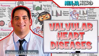 Valvular Heart Diseases  Clinical Medicine [upl. by Audette]