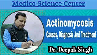 Actinomycosis Causes Diagnosis And Treatment  Deepak PD Singh  Actinomycetes [upl. by Atworth785]