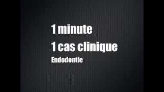 Une minute un cas clinique  Episode 1  Endodontie [upl. by Jim739]