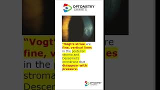 🔍 Unlocking the Secrets of Vogts Striae keratoconus vogt s striae opthalmology viralvideo [upl. by Galloway]