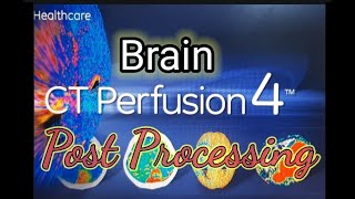 Stroke How to do Brain CT Perfusion Post Processing [upl. by Urissa]