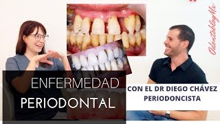 TODO SOBRE la Enfermedad Periodontal [upl. by Nnyleuqaj]