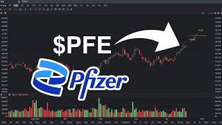 PFE Stock Price Prediction Will Go Up  PFE stock analysis [upl. by Anelle]