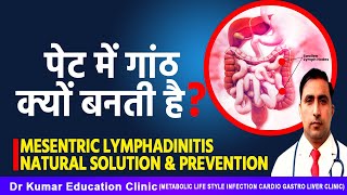 पेट में गांठ क्यों बनती हैMESENTRIC LYMPHADINITIS NATURAL SOLUTION amp PREVENTION [upl. by Maccarone]