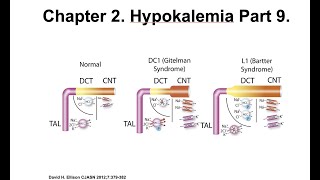 Hypokalemia Part 9 Case Studies [upl. by Frieder]