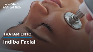 Tratamiento Indiba Facial Sesión en vivo [upl. by Crandell76]