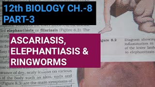 Class 12 biology chapter 8part 3human diseasesStudy with Farru [upl. by Avilys220]