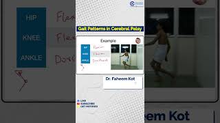 Dr Faheem Kotekar Explains Gait Patterns in Cerebral Palsy  Conceptual Orthopedics [upl. by Bouzoun]