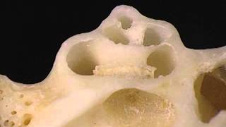 Aclands Video Atlas of Human Anatomy Cochlea [upl. by Rennob]