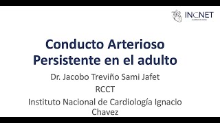 CONDUCTO ARTERIOSO PERSISTENTE EN EL ADULTO [upl. by Kathe836]