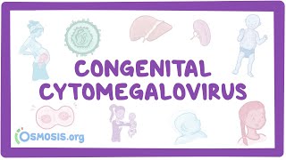 Congenital CMV  causes symptoms diagnosis treatment pathology [upl. by Nuahsyd]