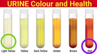 What The Color Of Your Urine Says About Your Health [upl. by Lekzehcey]