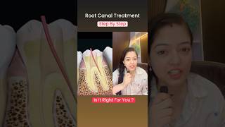 rootcanaltreatment shorts rootcanalspecialist rootcanal dental information doctor [upl. by Smallman725]