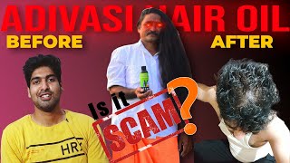 ADIVASI HAIR OIL SCAM  MY PERSONAL EXPERIENCE [upl. by Esinej]