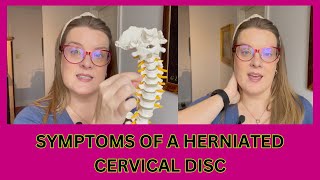 Herniated Cervical Disc Symptoms  Dr Kristina Turkewitsch Chiropractor in Newmarket [upl. by Madigan]