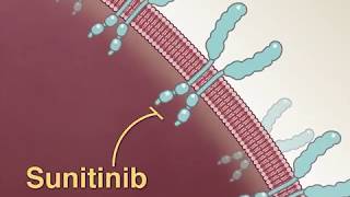 Treating Advanced RenalCell Carcinoma [upl. by Harry]