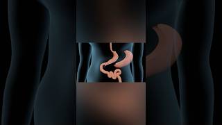 Sleeve Gastrectomy medicalanimation health shorts [upl. by Jenesia]