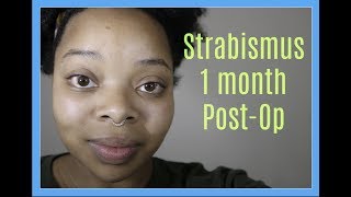 Strabismus Surgery Lazy Eye 1 Month PostOp [upl. by Naenaj]