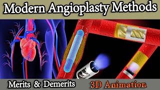 Different Angioplasty Methods Stents Balloon atherectomy Rotablator [upl. by Nollahs]