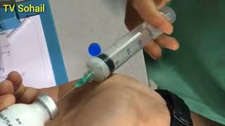 How to Load Injection Propofol  TV Sohail [upl. by Yadnus]