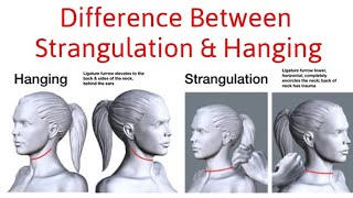 Difference Between Hanging and Strangulation [upl. by Akeem571]