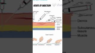 Different route of injection administration of drugs route injection shorts 3danimation viral [upl. by Prunella632]