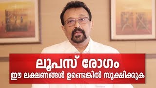 എന്താണ് ലൂപസ് രോഗം  SLE or Lupus Disease Malayalam Health Tips [upl. by Eigla]