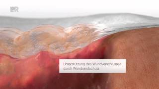 Suprasorb® Liquacel Deutsch [upl. by Sorvats]