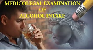 7 medicolegal examination of an alcoholic [upl. by Ajim]