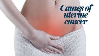 CAUSES OF UTERINE CANCER [upl. by Becki]