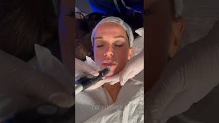 Satisfying HYDRAFACIAL ASMR Sound on 🔉 [upl. by Freida]