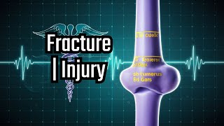 Humerus Bone Basic and Applied Anatomy common fractures partial claw handthecomplete claw hand [upl. by Oramlub]