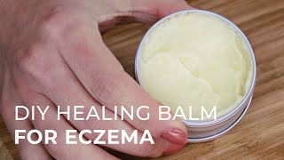 Tutorial for making a Natural Healing Cream for Eczema and Psoriasis [upl. by Narej]