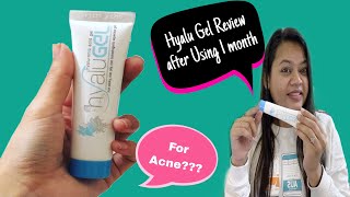 Hyalu Gel Hyaluronic Acid gel Review after Using 1 Month  What is the use of Hyalu gel [upl. by Bbor32]