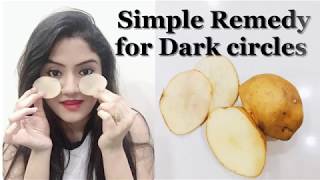 100 Natural and Effective home remedy for dark circles  In Hindi [upl. by Miza]