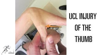 UCL injury of the thumb Mechanism of injury and treatment options [upl. by Akemot]