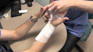 Ulnar Gutter Splint Howto [upl. by Naitsabes229]