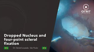 Orbit tips 052  Dropped Nucleus and fourpoint scleral fixation [upl. by Nosirrah]