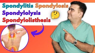 Discover the Key Differences Spondylitis vs Spondylosis vs Spondylolysis vs Spondylolisthesis [upl. by Anna-Maria]