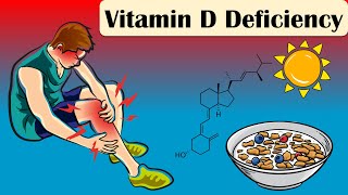 Vitamin D Deficiency  Causes Signs And Symptoms  Everything You Need To Know [upl. by Reynolds]